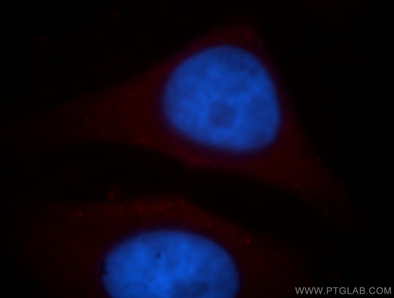 Immunofluorescence (IF) / fluorescent staining of HepG2 cells using NAT1 Polyclonal antibody (19188-1-AP)