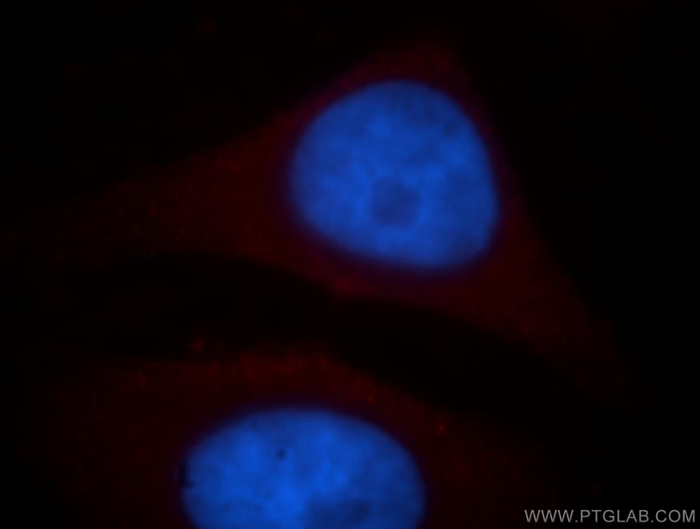 IF Staining of HepG2 using 19188-1-AP