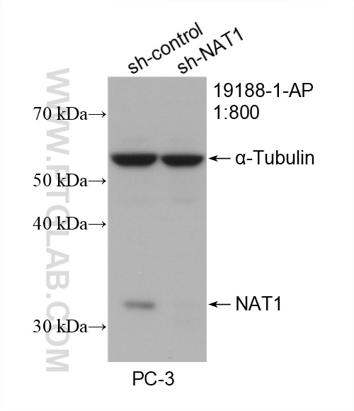 Western Blot (WB) analysis of PC-3 cells using NAT1 Polyclonal antibody (19188-1-AP)