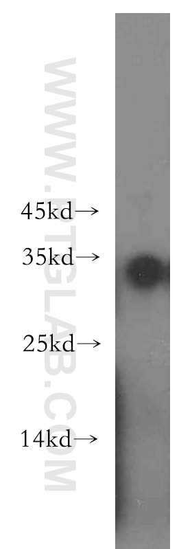 Western Blot (WB) analysis of PC-3 cells using NAT1 Polyclonal antibody (19188-1-AP)