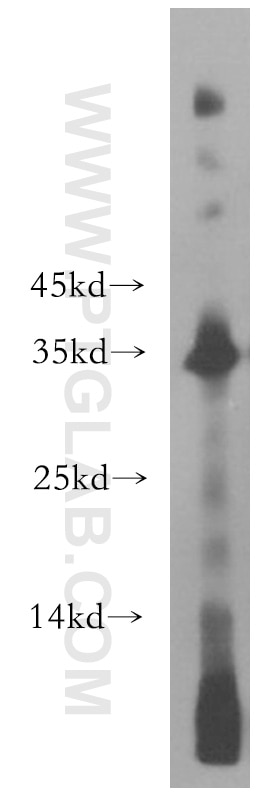 Western Blot (WB) analysis of human placenta tissue using NAT1 Polyclonal antibody (19188-1-AP)