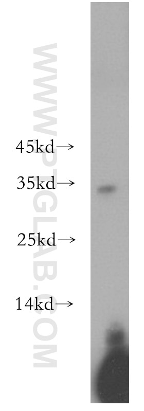 Western Blot (WB) analysis of A375 cells using NAT1 Polyclonal antibody (19188-1-AP)