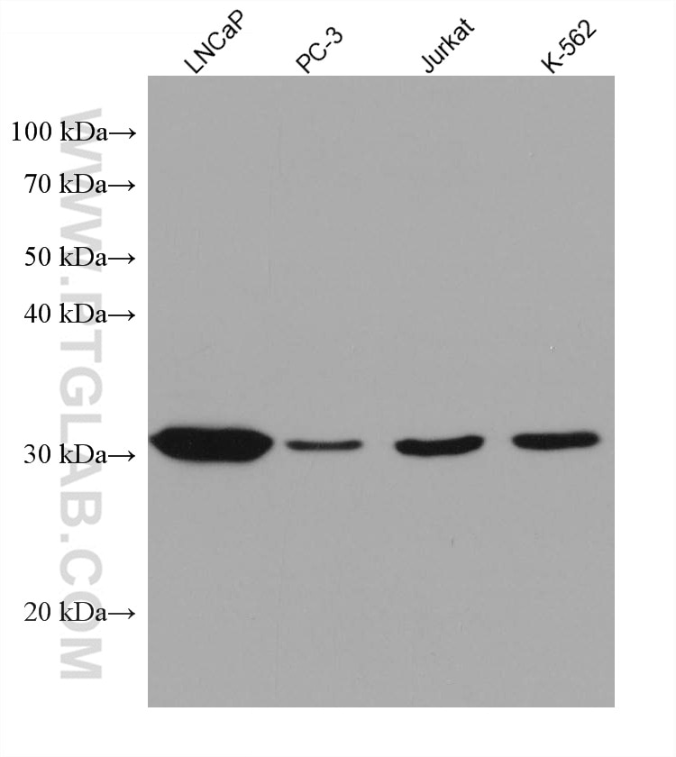 Western Blot (WB) analysis of various lysates using NAT1 Monoclonal antibody (67942-1-Ig)