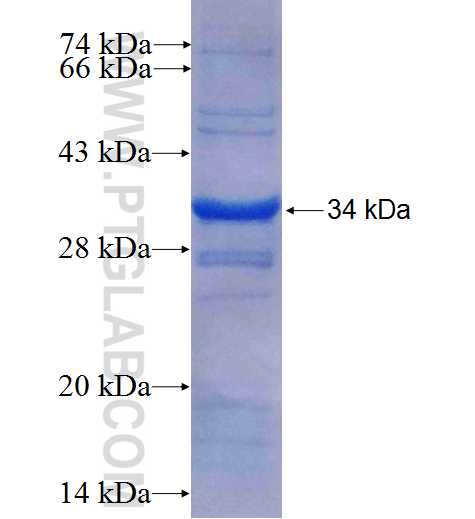 NAT1 fusion protein Ag6280 SDS-PAGE