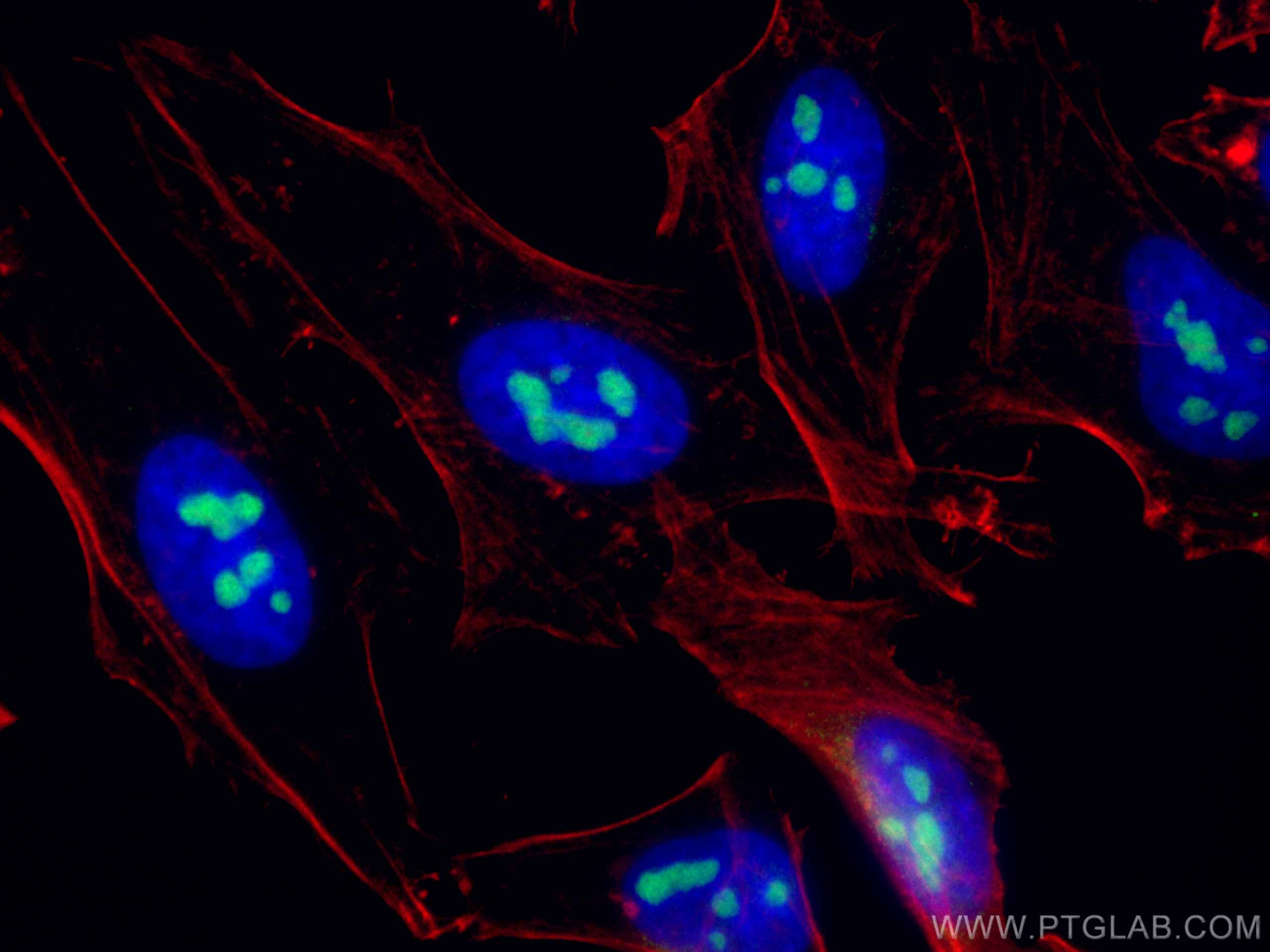 Immunofluorescence (IF) / fluorescent staining of HeLa cells using NAT10 Polyclonal antibody (13365-1-AP)