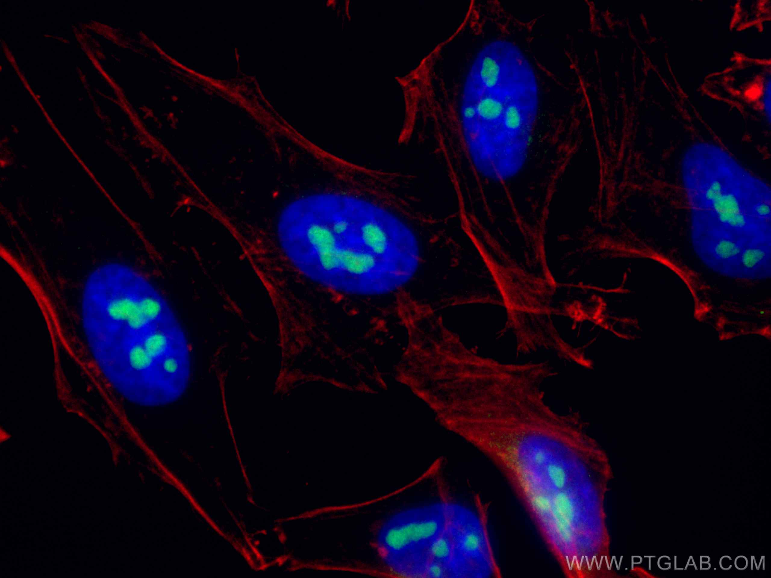 IF Staining of HeLa using 13365-1-AP