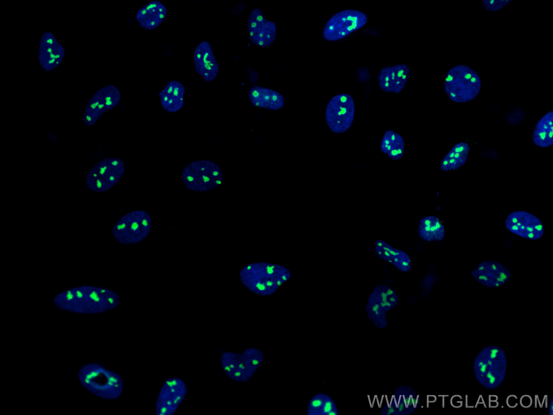 Immunofluorescence (IF) / fluorescent staining of HeLa cells using NAT10 Polyclonal antibody (13365-1-AP)