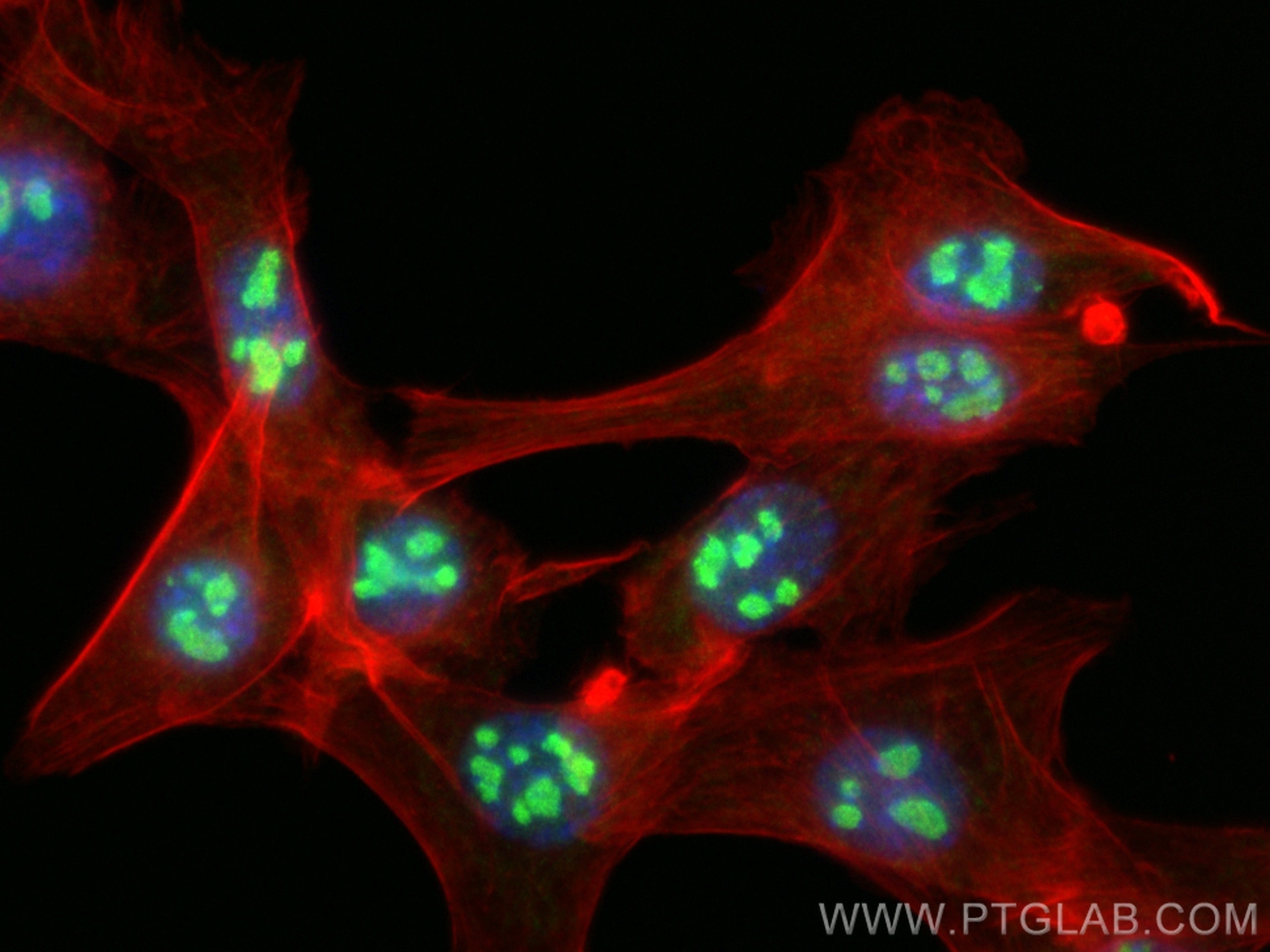 Immunofluorescence (IF) / fluorescent staining of NIH/3T3 cells using NAT10 Polyclonal antibody (13365-1-AP)
