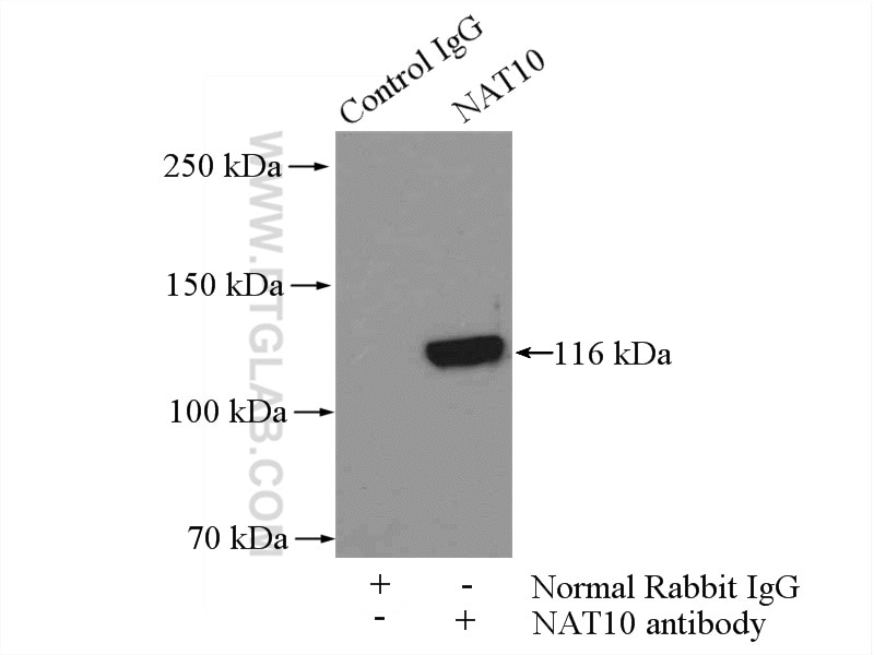 Immunoprecipitation (IP) experiment of mouse testis tissue using NAT10 Polyclonal antibody (13365-1-AP)