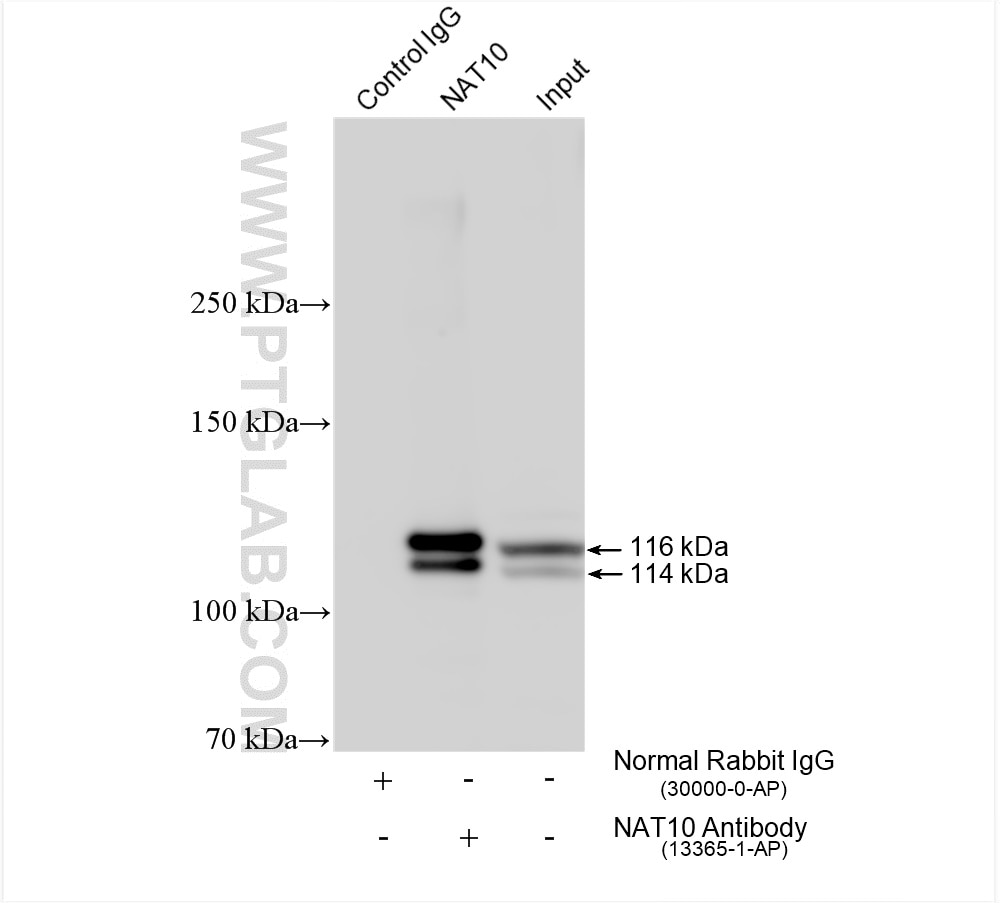 Immunoprecipitation (IP) experiment of mouse testis tissue using NAT10 Polyclonal antibody (13365-1-AP)