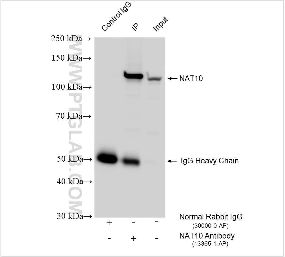 Immunoprecipitation (IP) experiment of HEK-293 cells using NAT10 Polyclonal antibody (13365-1-AP)