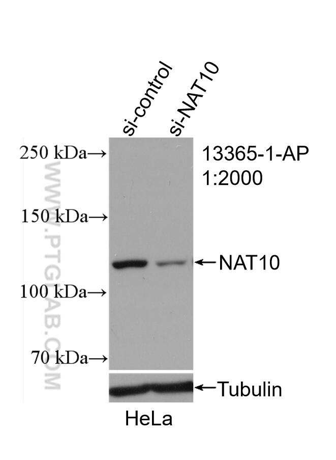 Western Blot (WB) analysis of HeLa cells using NAT10 Polyclonal antibody (13365-1-AP)