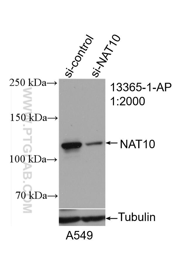 Western Blot (WB) analysis of A549 cells using NAT10 Polyclonal antibody (13365-1-AP)