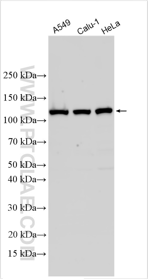 Western Blot (WB) analysis of various lysates using NAT10 Polyclonal antibody (13365-1-AP)