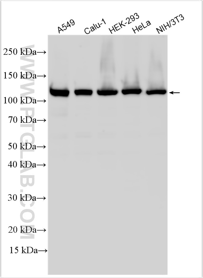 Western Blot (WB) analysis of various lysates using NAT10 Polyclonal antibody (13365-1-AP)