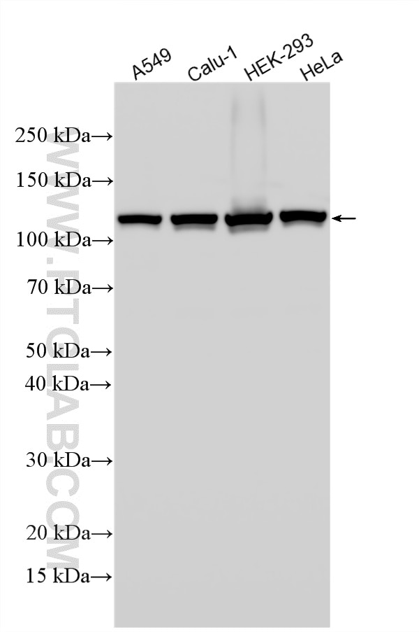 Western Blot (WB) analysis of various lysates using NAT10 Polyclonal antibody (13365-1-AP)