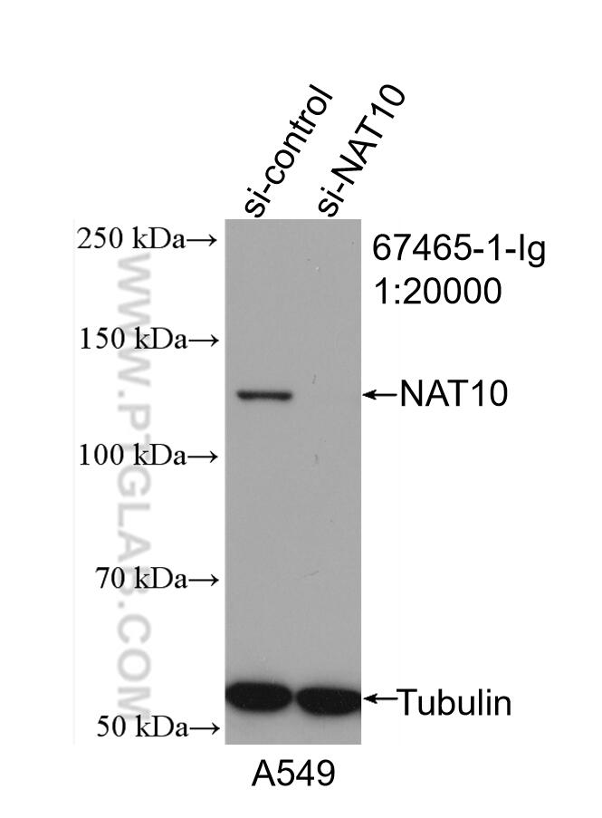 Western Blot (WB) analysis of A549 cells using NAT10 Monoclonal antibody (67465-1-Ig)