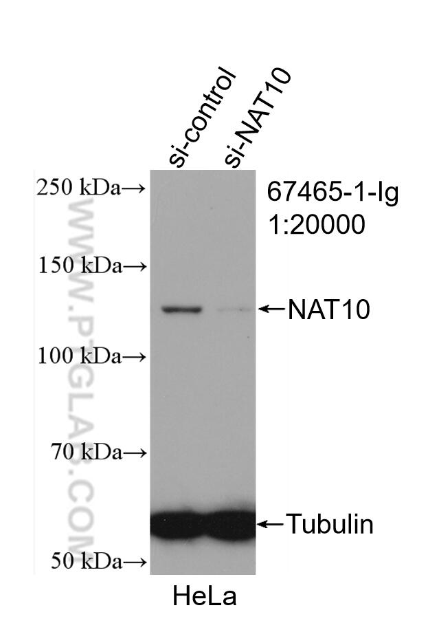 Western Blot (WB) analysis of HeLa cells using NAT10 Monoclonal antibody (67465-1-Ig)