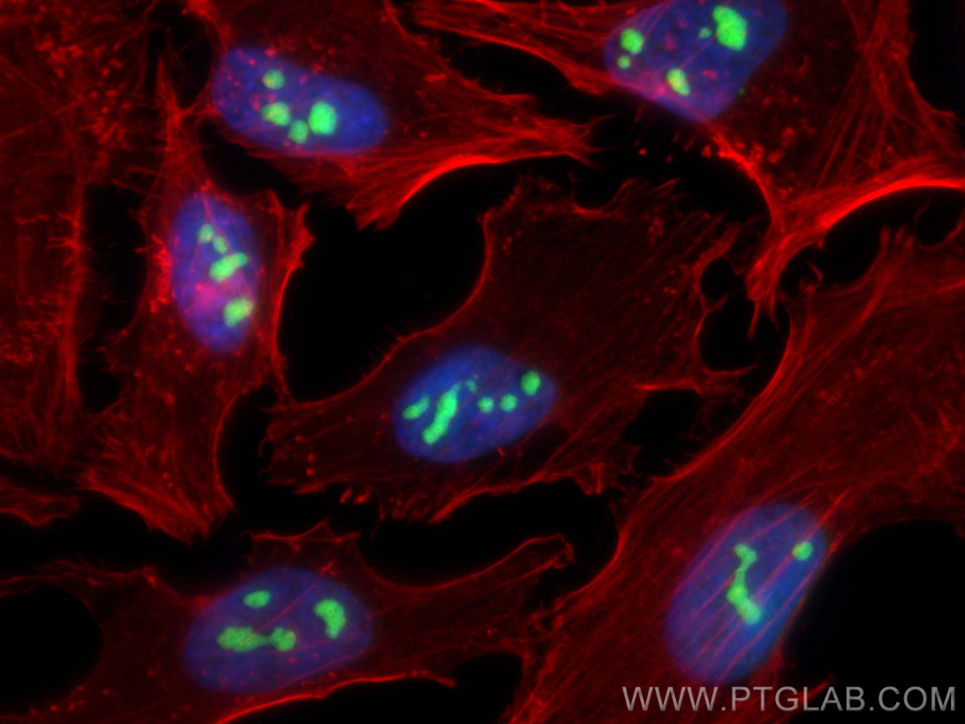 Immunofluorescence (IF) / fluorescent staining of HeLa cells using NAT10 Recombinant antibody (82585-1-RR)
