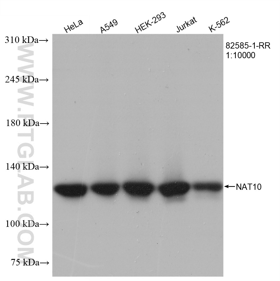 Western Blot (WB) analysis of various lysates using NAT10 Recombinant antibody (82585-1-RR)