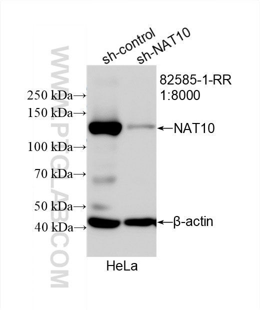Western Blot (WB) analysis of HeLa cells using NAT10 Recombinant antibody (82585-1-RR)
