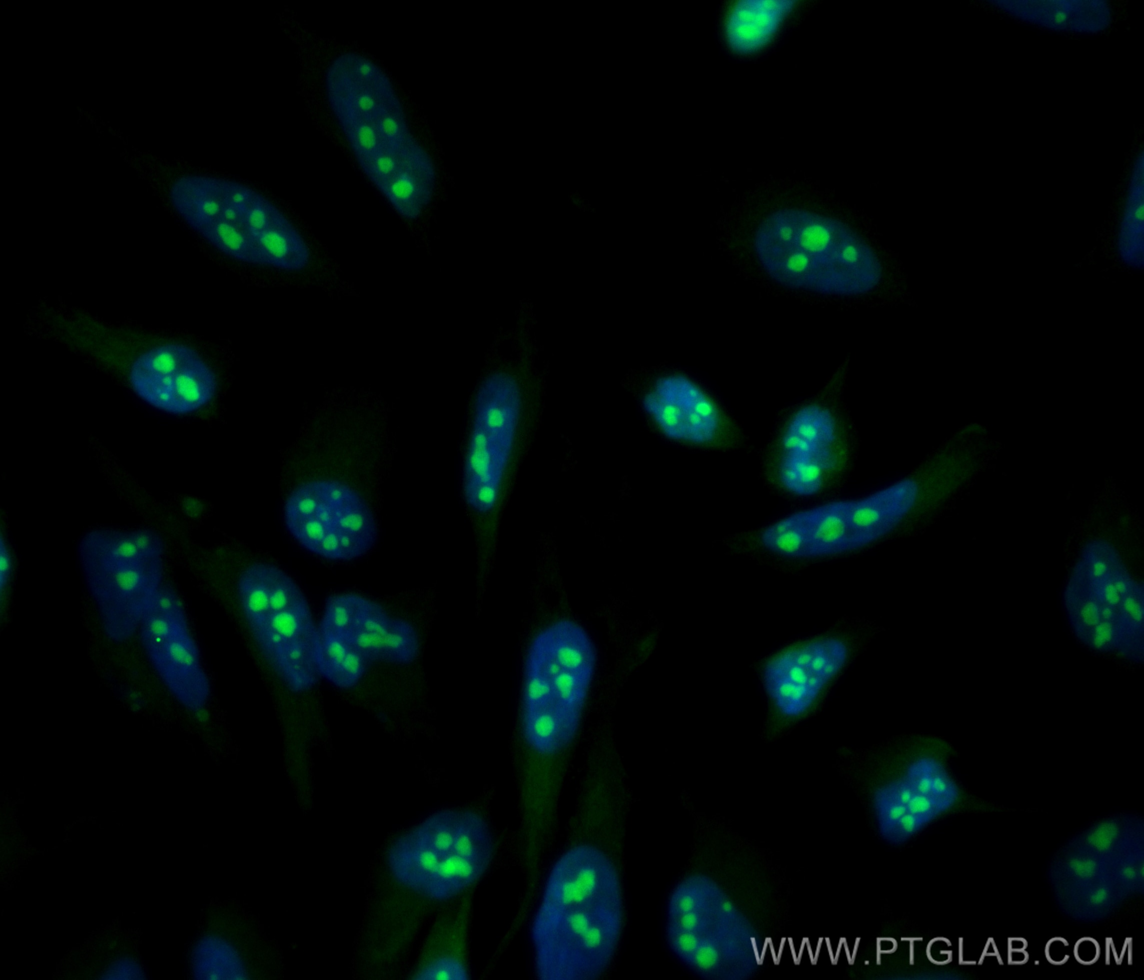 Immunofluorescence (IF) / fluorescent staining of HeLa cells using CoraLite® Plus 488-conjugated NAT10 Polyclonal ant (CL488-13365)