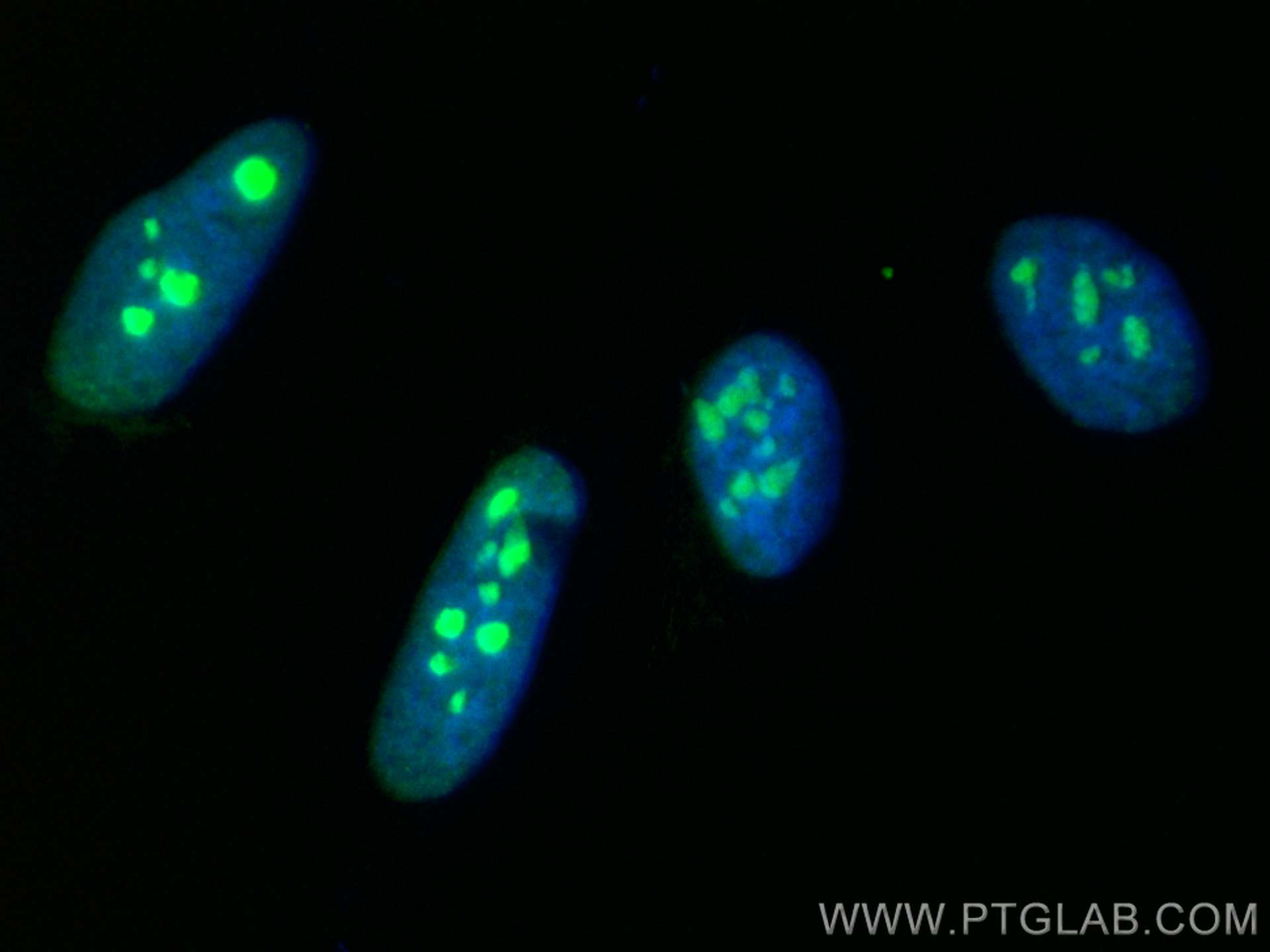 Immunofluorescence (IF) / fluorescent staining of HeLa cells using CoraLite® Plus 488-conjugated NAT10 Recombinant an (CL488-82585)