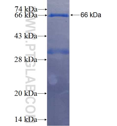 NAT10 fusion protein Ag4184 SDS-PAGE