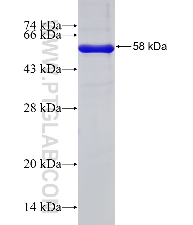 NAT10 fusion protein Ag4355 SDS-PAGE