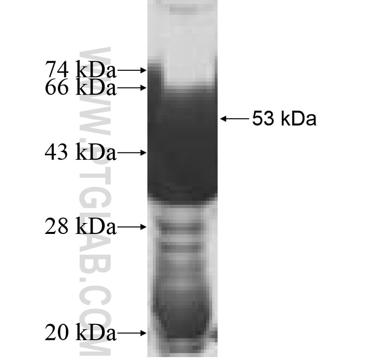 NAT11 fusion protein Ag10092 SDS-PAGE