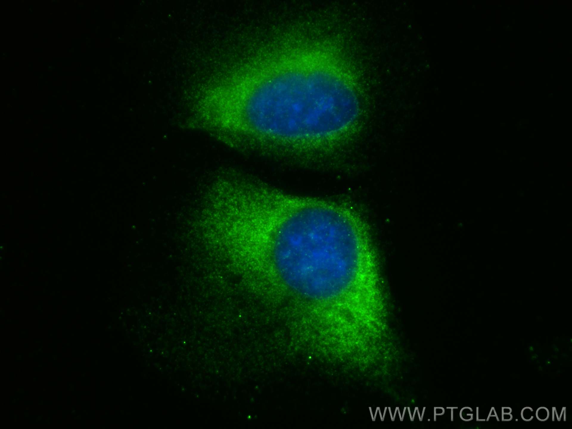 Immunofluorescence (IF) / fluorescent staining of U2OS cells using NAT12 Polyclonal antibody (25149-1-AP)