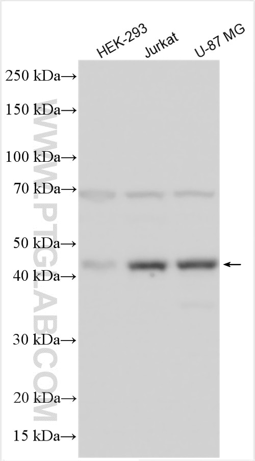 Western Blot (WB) analysis of various lysates using NAT12 Polyclonal antibody (25149-1-AP)