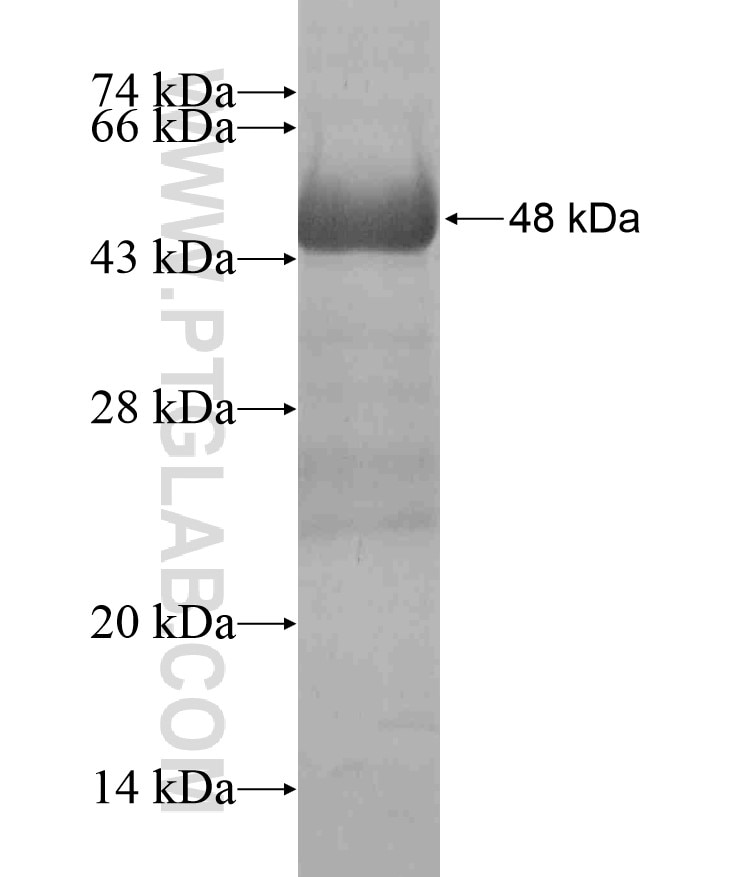 NAT12 fusion protein Ag18425 SDS-PAGE