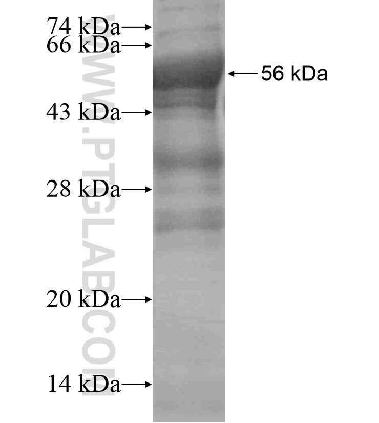 NAT12 fusion protein Ag18435 SDS-PAGE