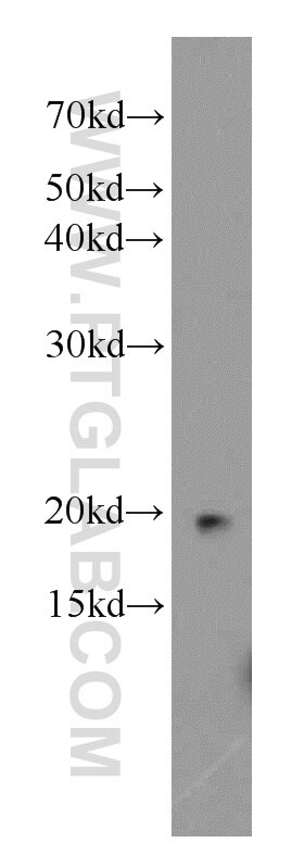 Western Blot (WB) analysis of K-562 cells using NAT13 Polyclonal antibody (16120-1-AP)