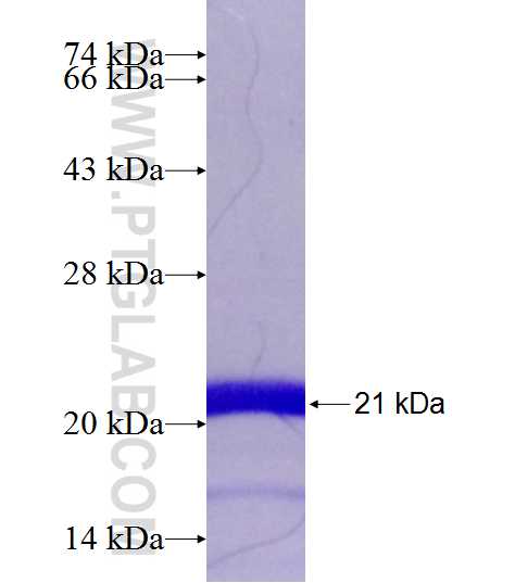 NAT13 fusion protein Ag9089 SDS-PAGE