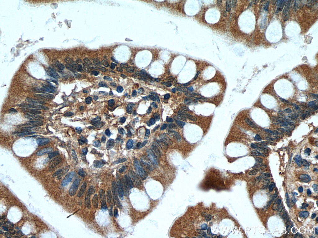 Immunohistochemistry (IHC) staining of human small intestine tissue using NAT2 Polyclonal antibody (11410-1-AP)