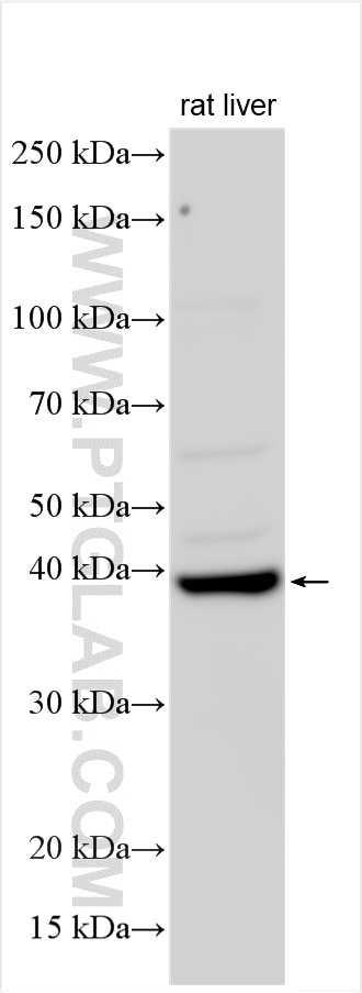Western Blot (WB) analysis of various lysates using NAT2 Polyclonal antibody (11410-1-AP)