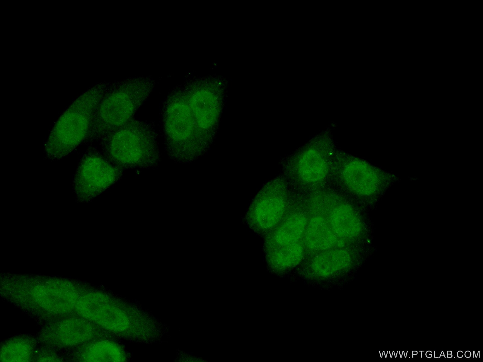 Immunofluorescence (IF) / fluorescent staining of HeLa cells using NAT5 Polyclonal antibody (15807-1-AP)