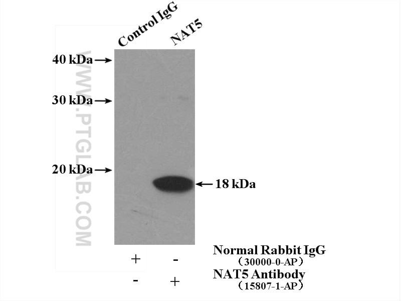 Immunoprecipitation (IP) experiment of HL-60 cells using NAT5 Polyclonal antibody (15807-1-AP)