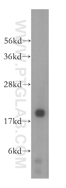 Western Blot (WB) analysis of HeLa cells using NAT5 Polyclonal antibody (15807-1-AP)