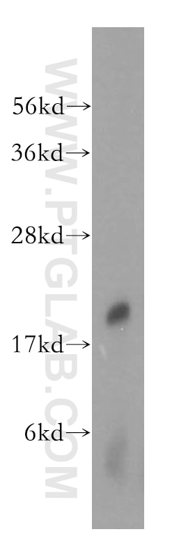 Western Blot (WB) analysis of human brain tissue using NAT5 Polyclonal antibody (15807-1-AP)