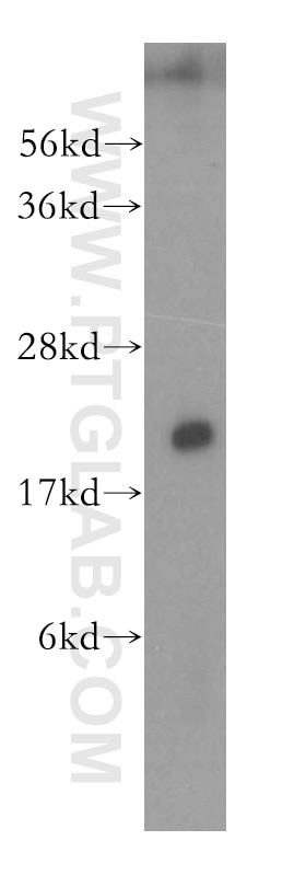 Western Blot (WB) analysis of HL-60 cells using NAT5 Polyclonal antibody (15807-1-AP)