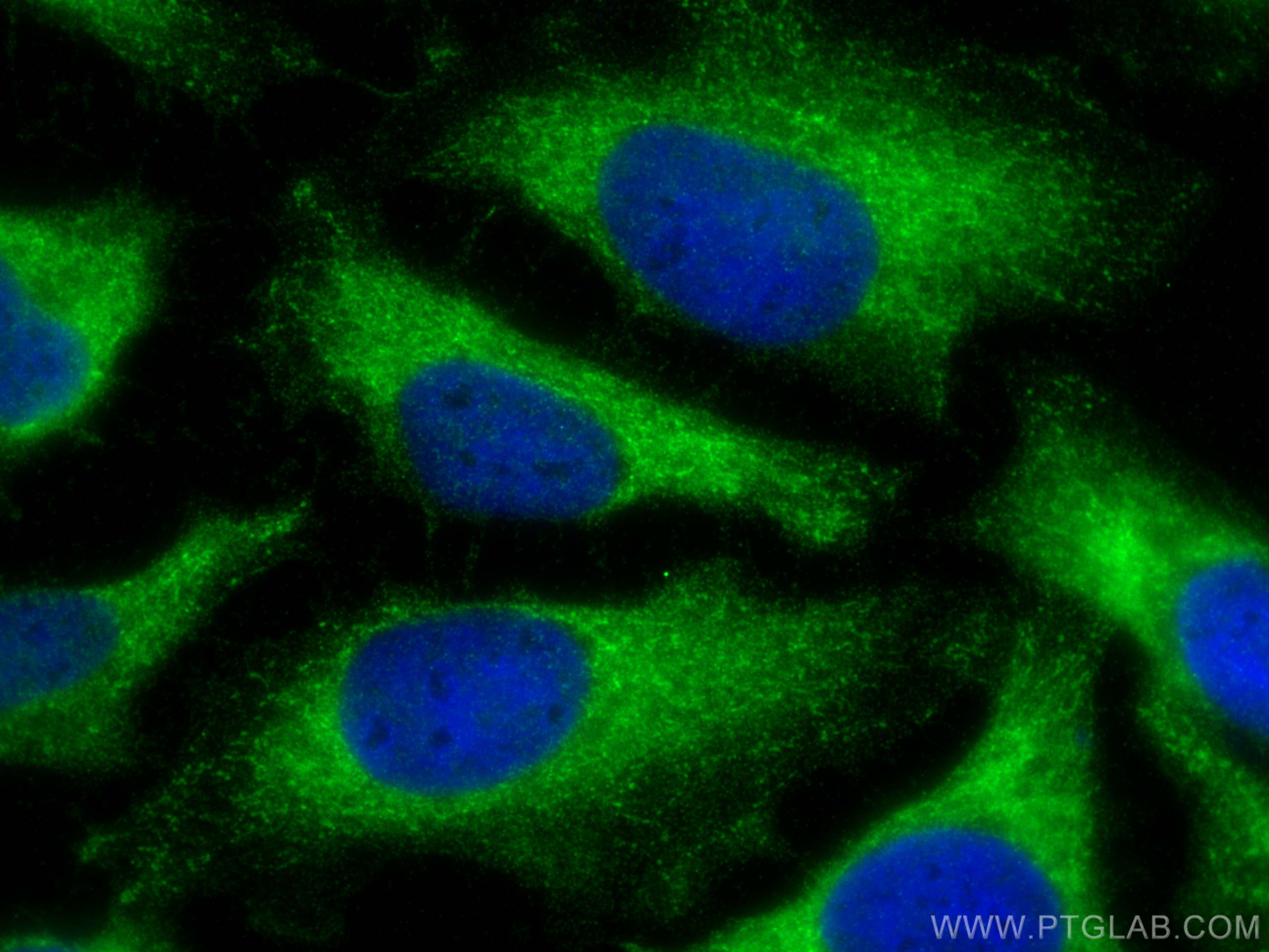 Immunofluorescence (IF) / fluorescent staining of HeLa cells using NAT6/FUS2 Polyclonal antibody (15476-1-AP)