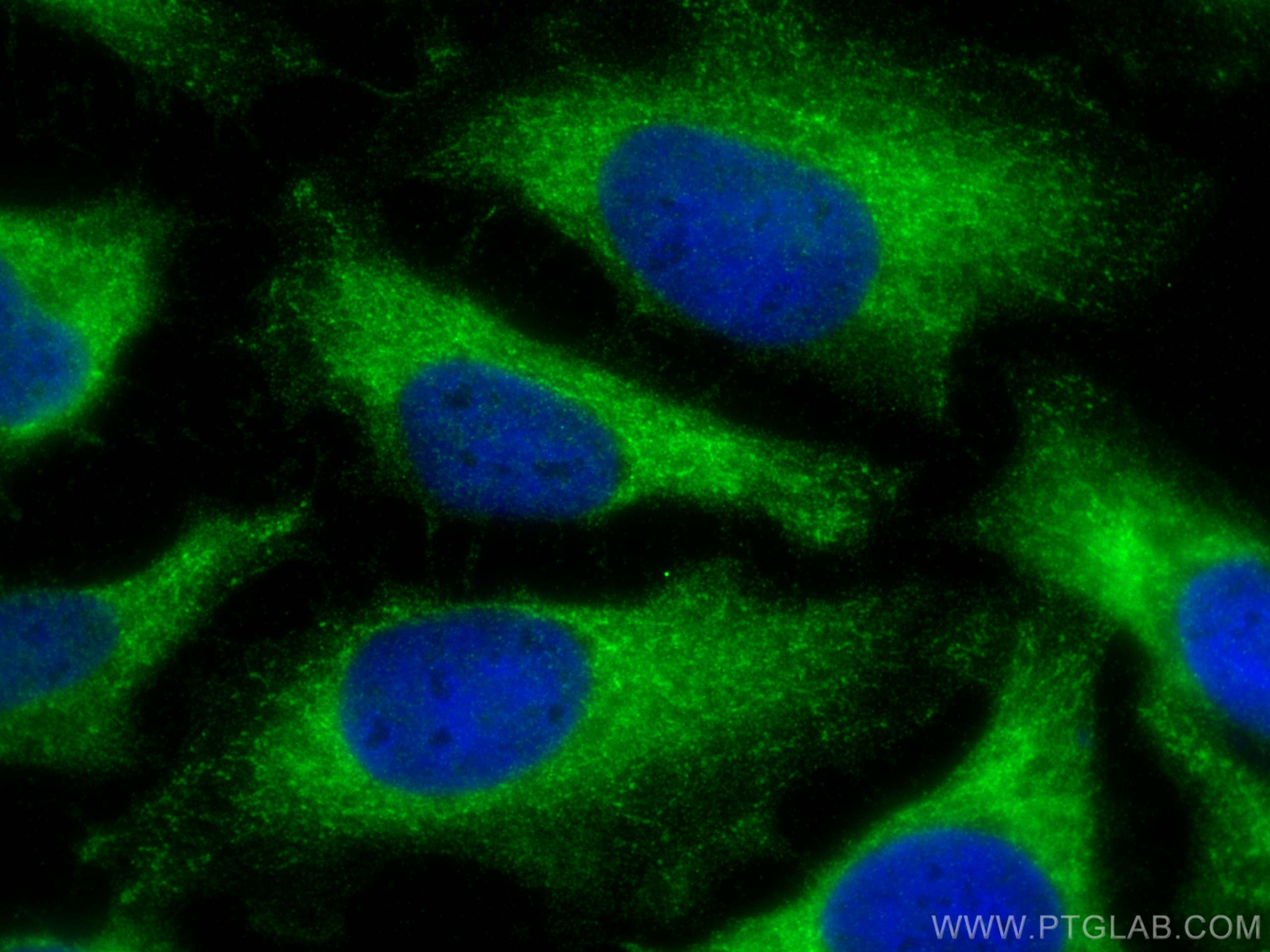 IF Staining of HeLa using 15476-1-AP