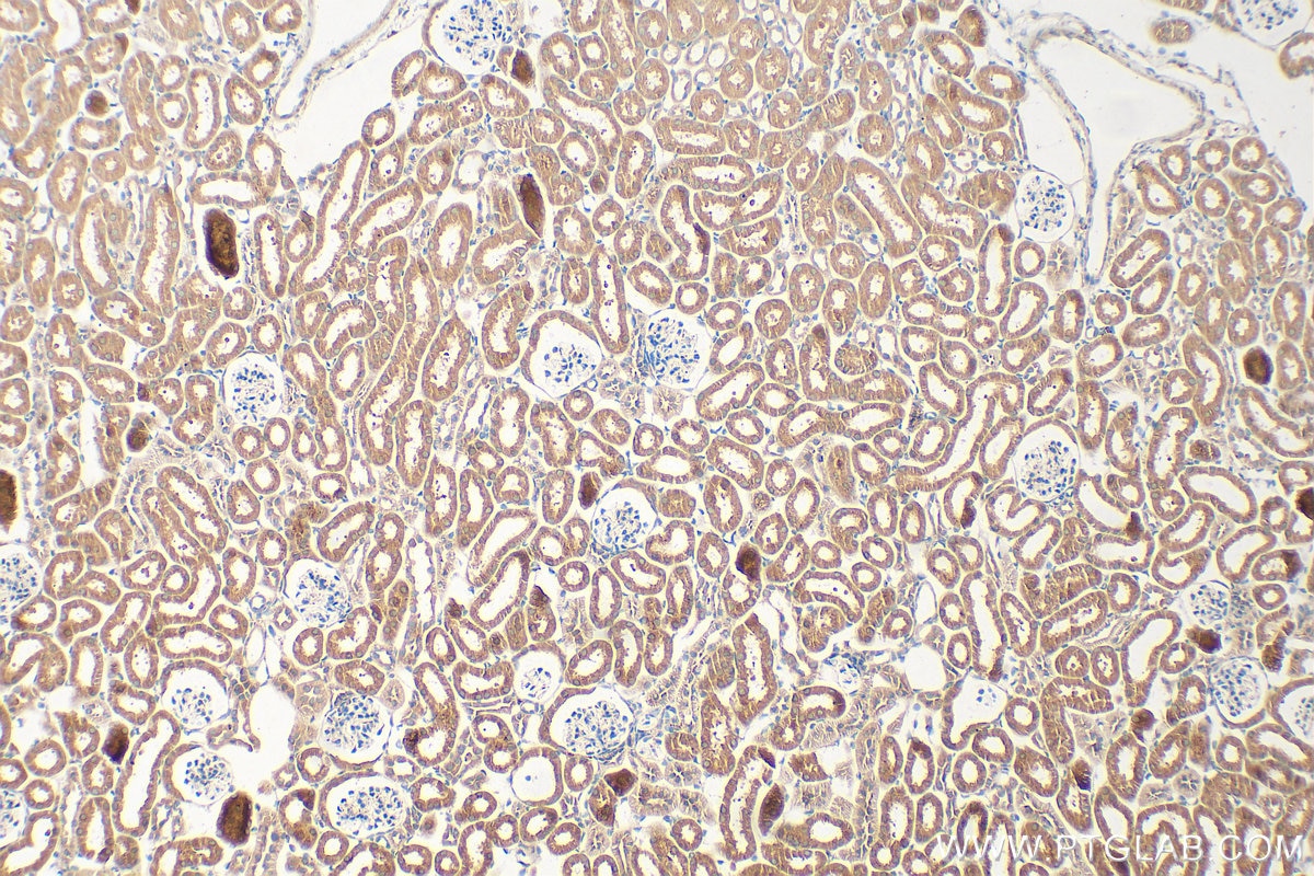 Immunohistochemistry (IHC) staining of mouse kidney tissue using NAT8 Polyclonal antibody (10908-1-AP)