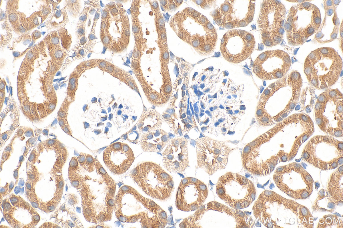 Immunohistochemistry (IHC) staining of mouse kidney tissue using NAT8 Polyclonal antibody (10908-1-AP)