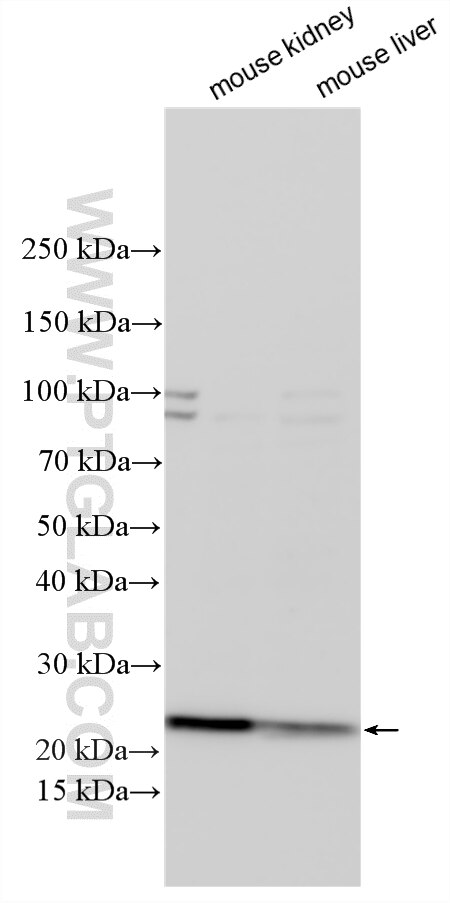 WB analysis using 10908-1-AP Western Blot (WB) analysis of various lysates using NAT8 Polyclonal antibody (10908-1-AP)