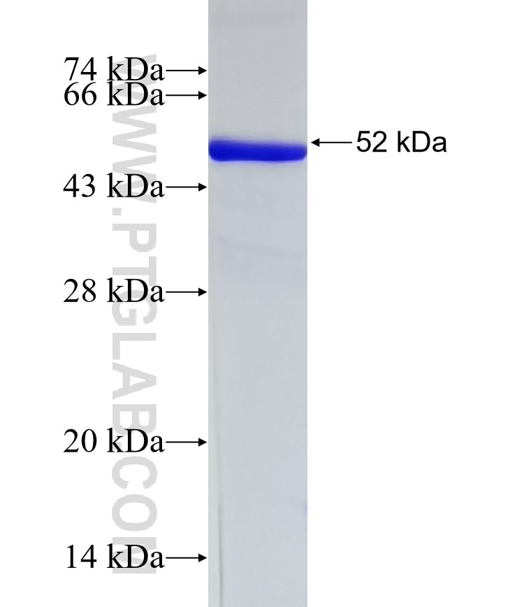 NAT8 fusion protein Ag1353 SDS-PAGE
