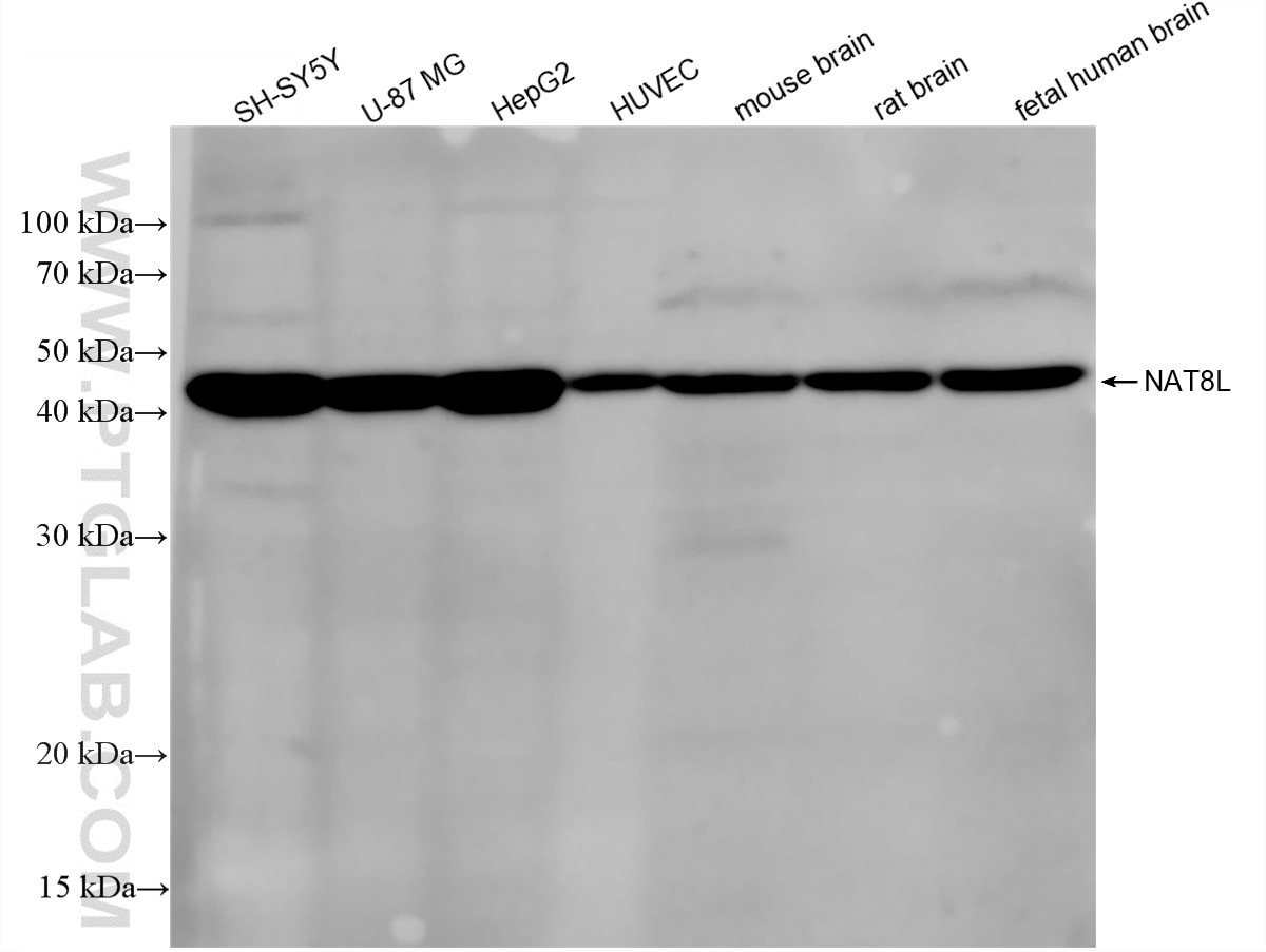 Western Blot (WB) analysis of various lysates using NAT8L Recombinant monoclonal antibody (87576-1-RR)